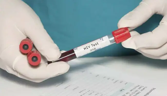 Hopes of HIV cure after breakthrough using gene-editing ‘scissors’