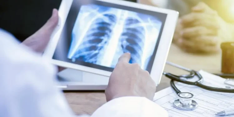 Des scientifiques kenyans testent une application d'IA pour diagnostiquer la tuberculose