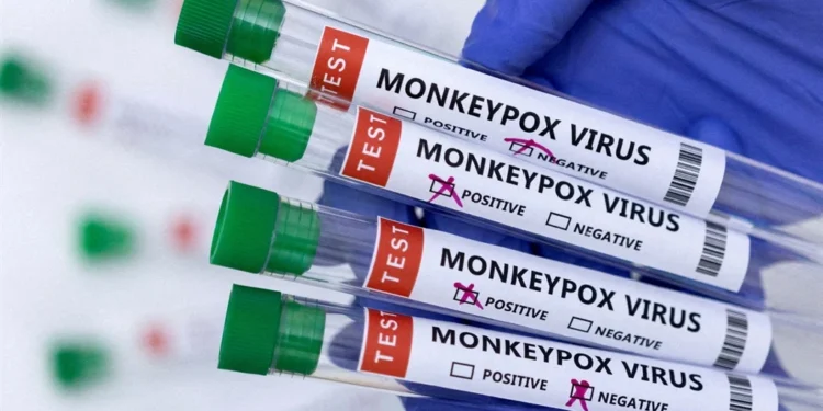 La nouvelle souche mpox en RD Congo est « la plus dangereuse à ce jour »