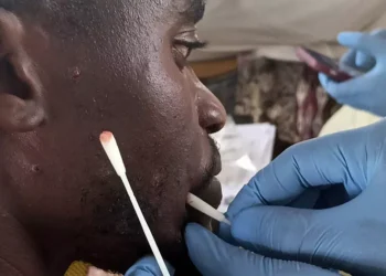 Le Ghana confirme 34 nouveaux cas de variole du singe, portant le nombre total à 79.