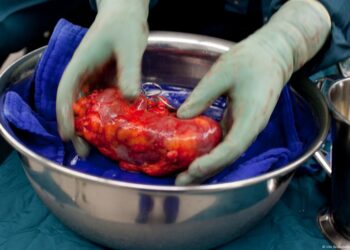 تقرير: تجارة الأعضاء البشرية تصل إلى أبعاد وبائية في إفريقيا