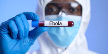 42 يومًا تفصل أوغندا عن إعلان خلوها من الإيبولا